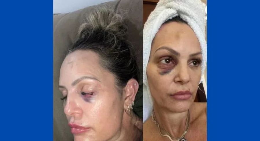 Investigador da Polícia Civil é condenado a 15 anos de prisão por agressões contra ex-esposa em Cuiabá