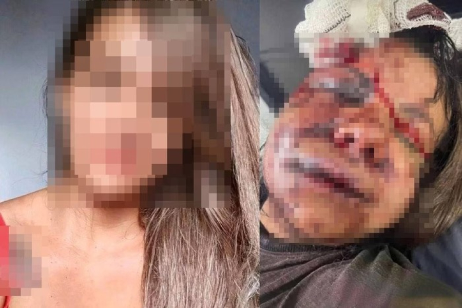 Ex-jogador de basquete é preso após espancar brutalmente ex-namorada em elevador 